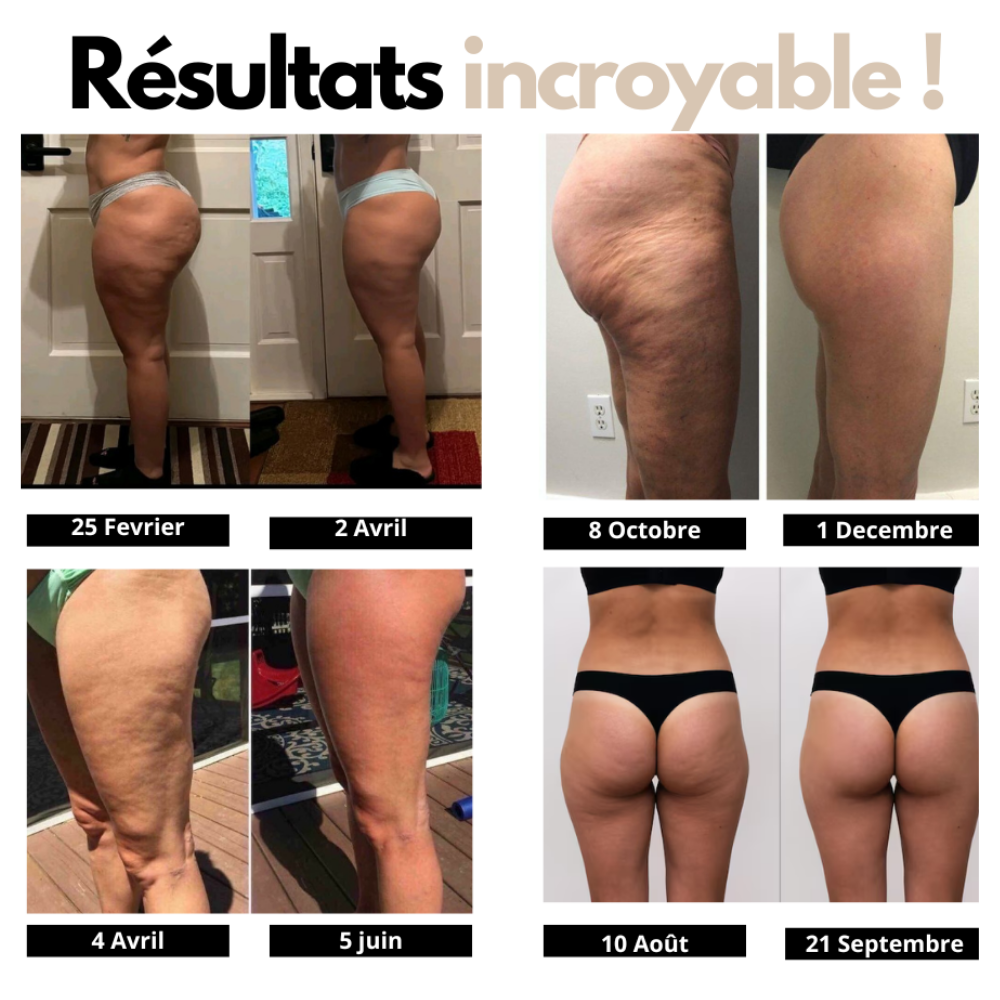 LEGGINGS ANTI-CELLULITE YOUR BRAND 